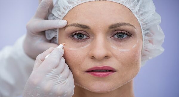 uno de los cirujanos de blefaroplastia, marca la zona de las ojeras paciente femenina, para realizarle el procedimiento estetico